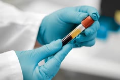 Pruebas de Quimica Clinica